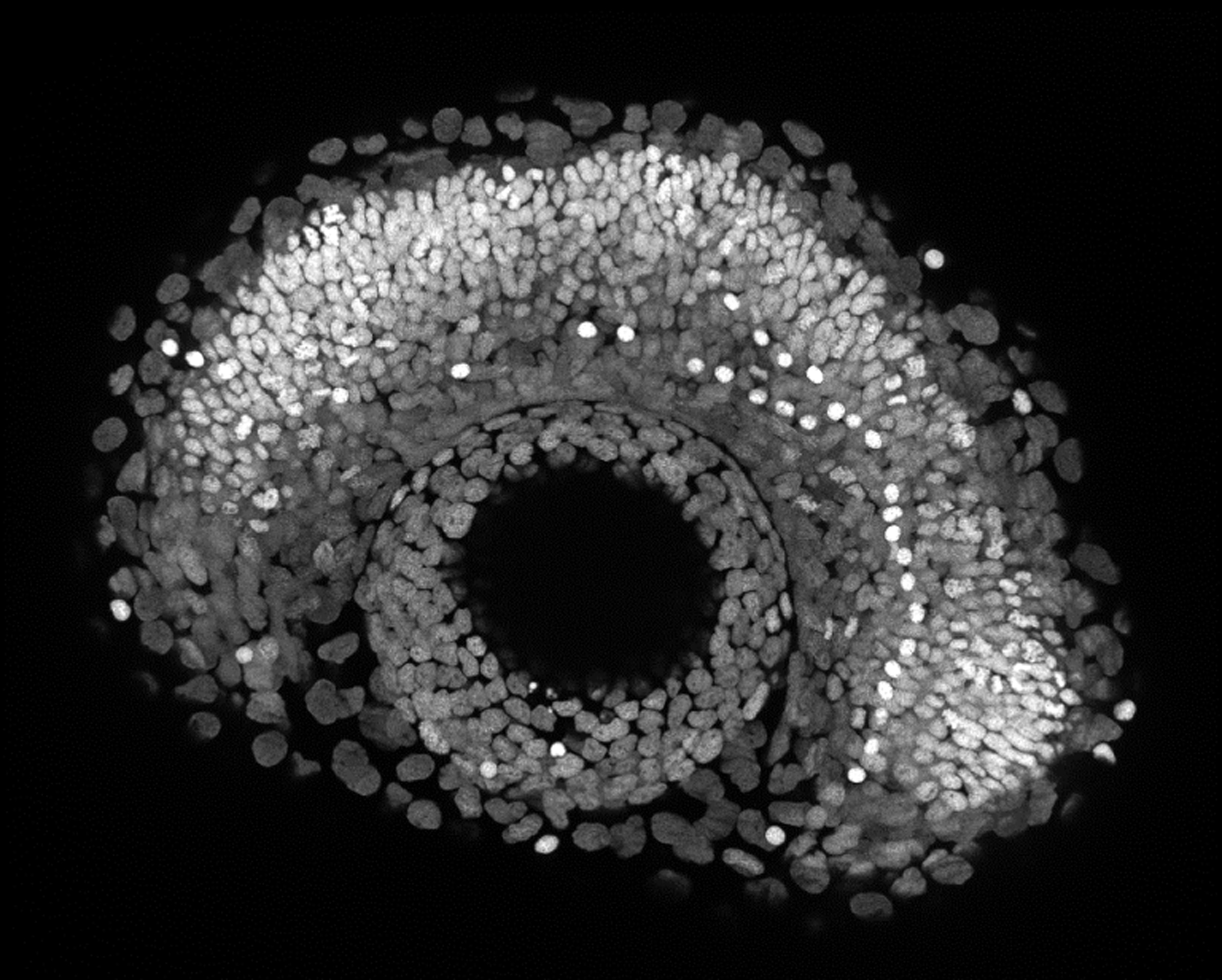 Zebrafish eye.