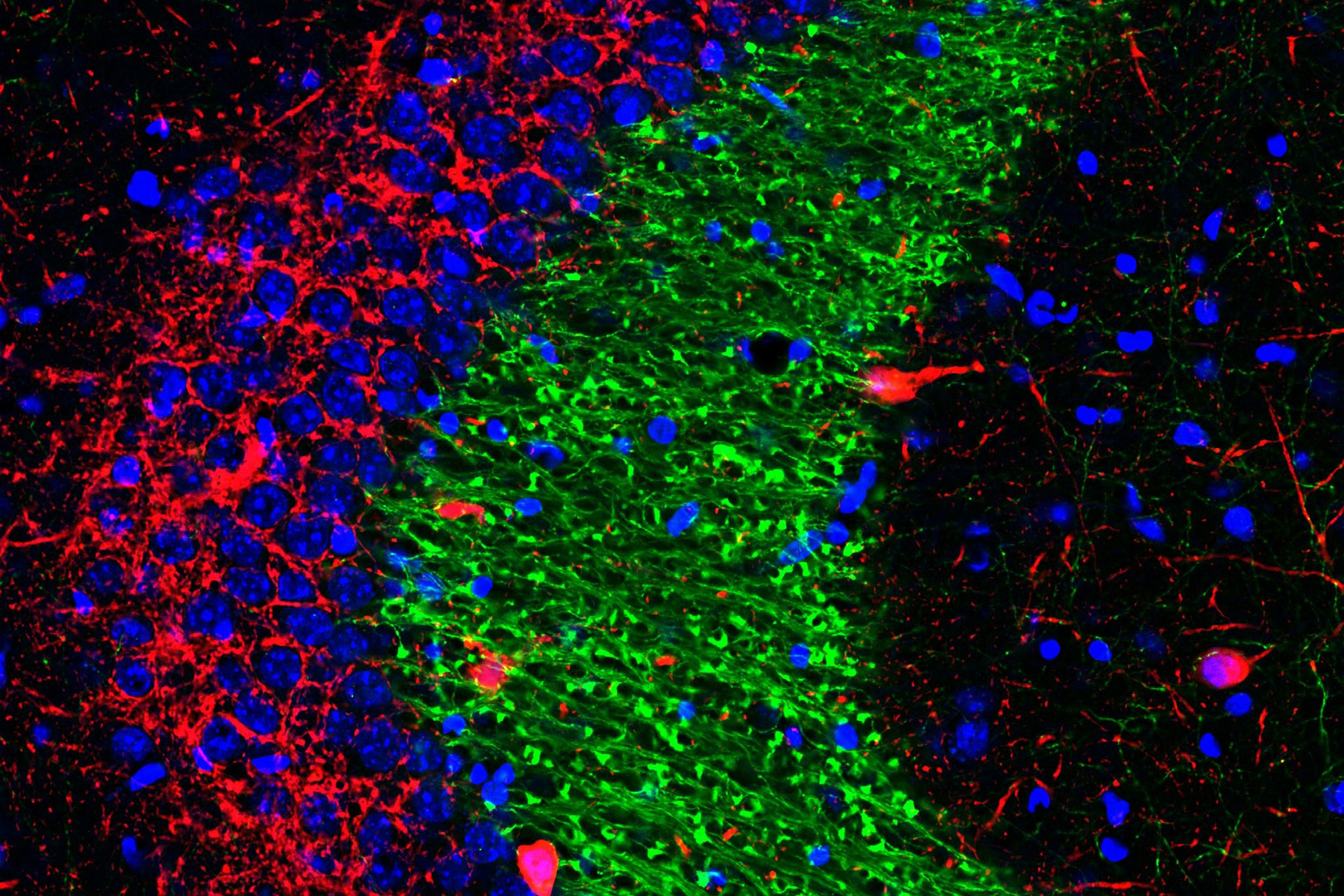 dentate gyrus cell