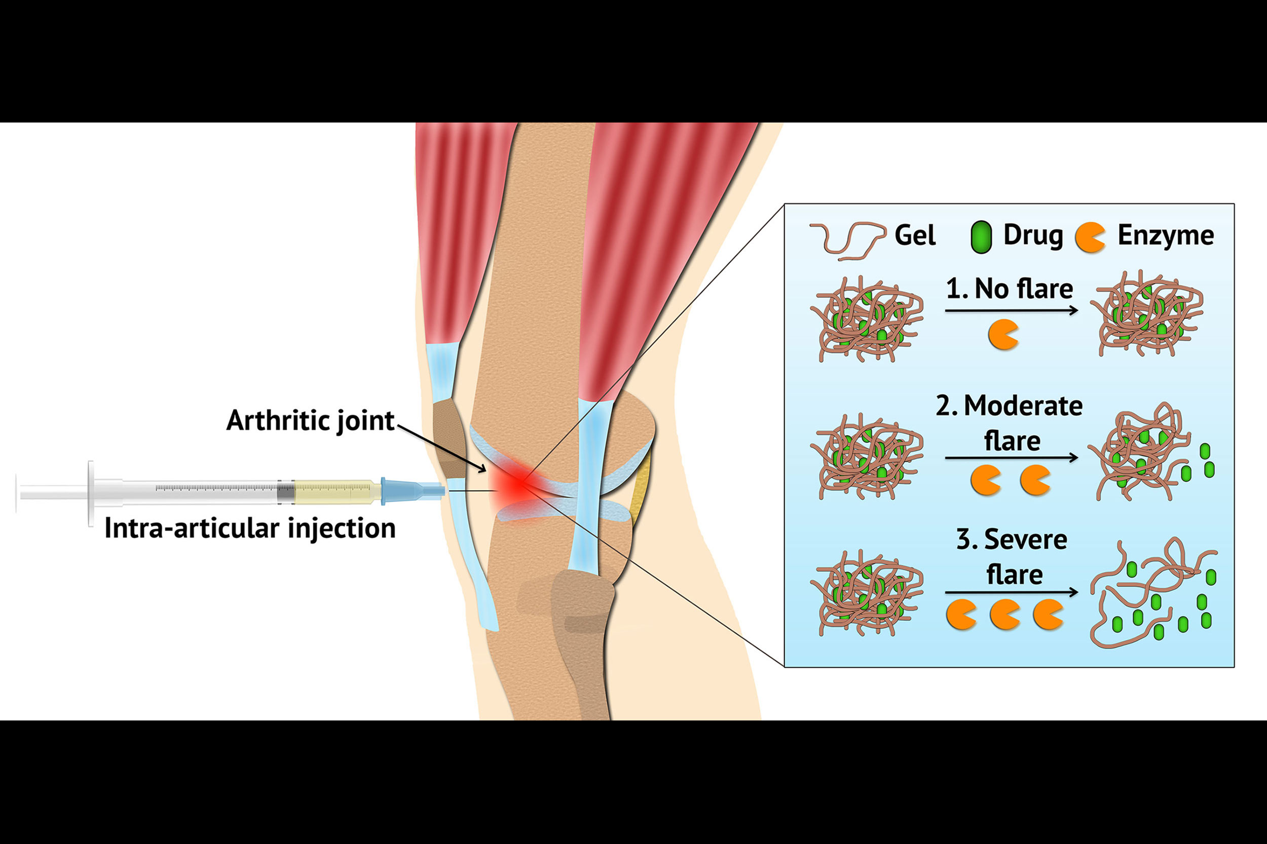 A delivery system using hydrogel