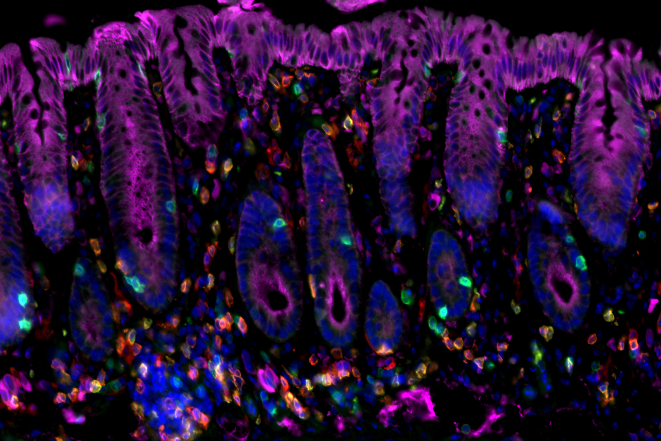 Cancer cells in mouse