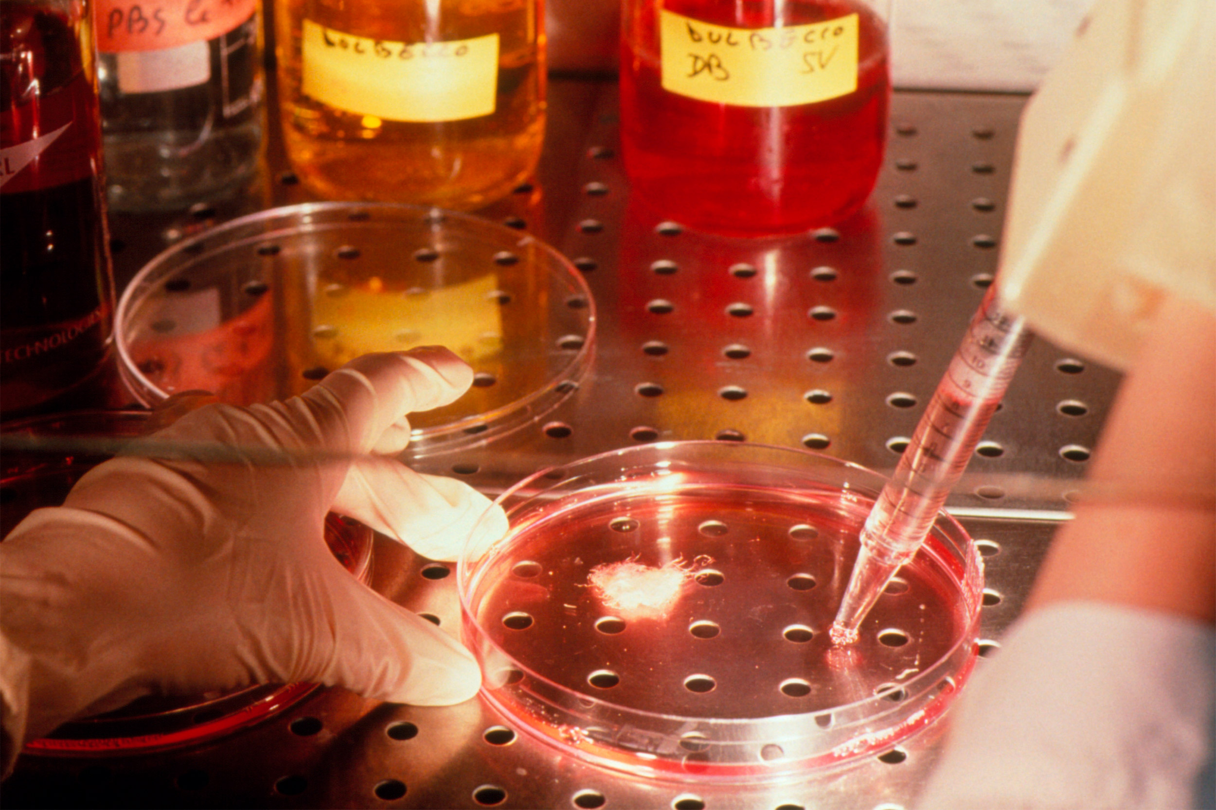 Preparing a gene therapy implant in a petri dish