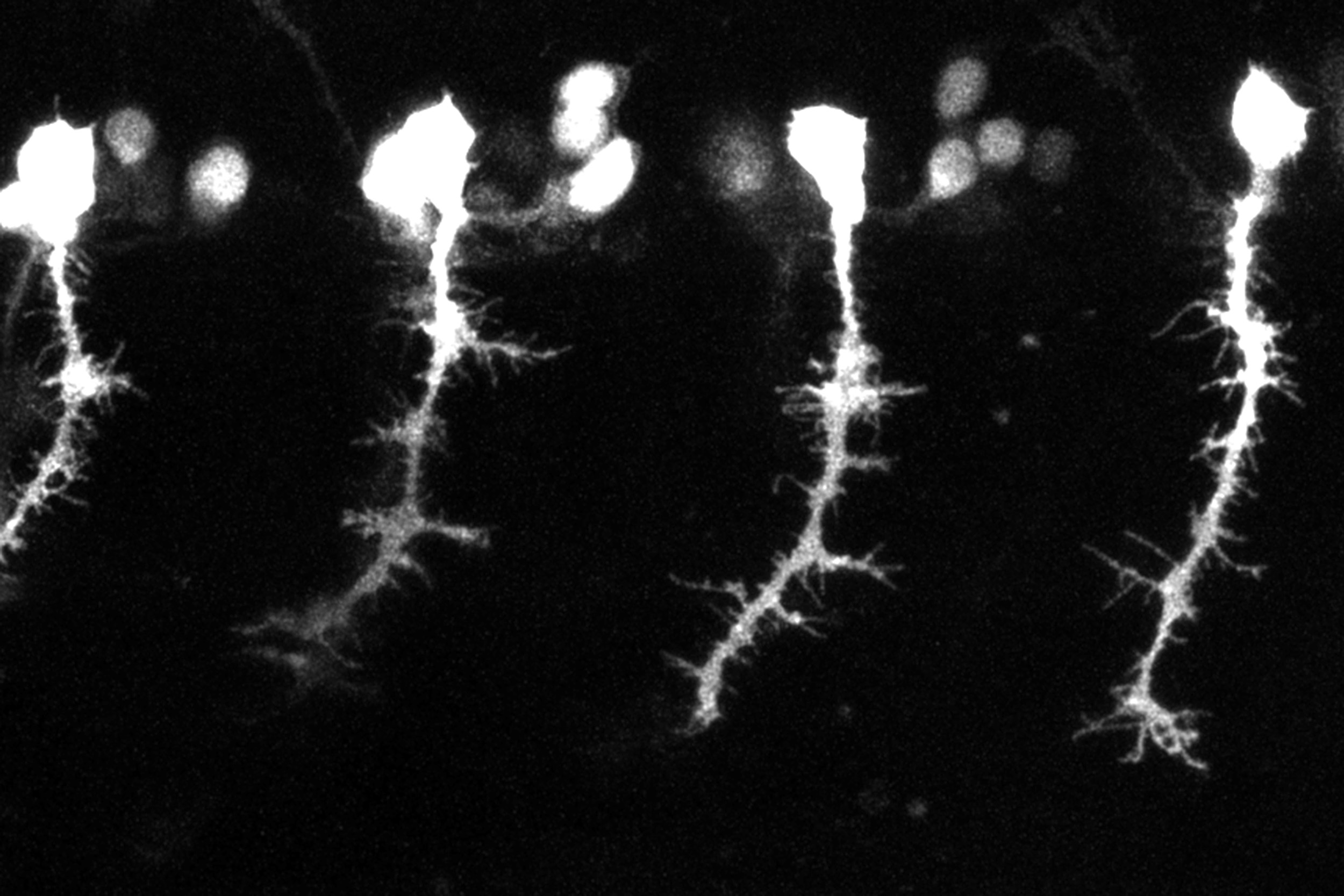 Neurons.