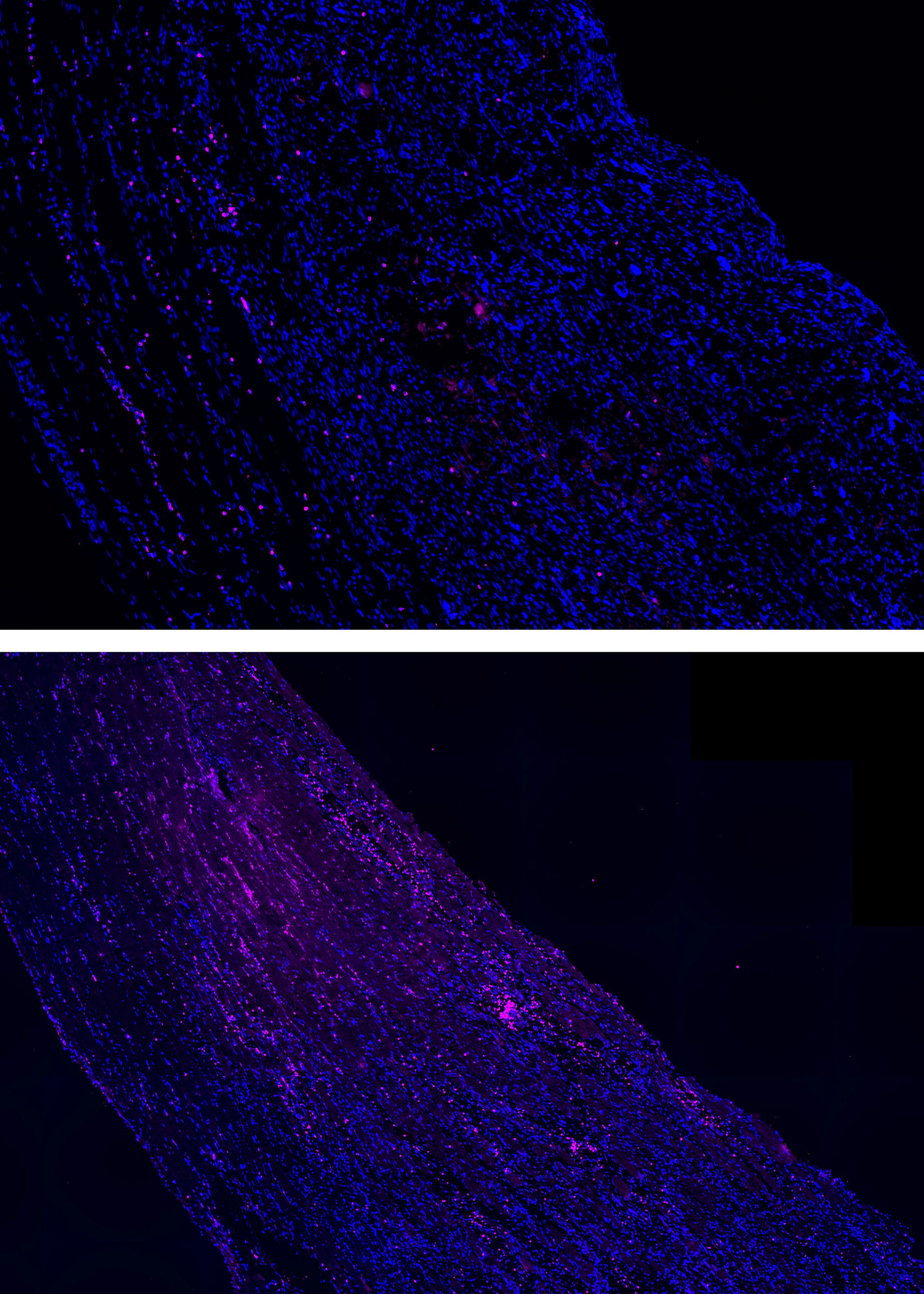 Treated and untreated muscles.