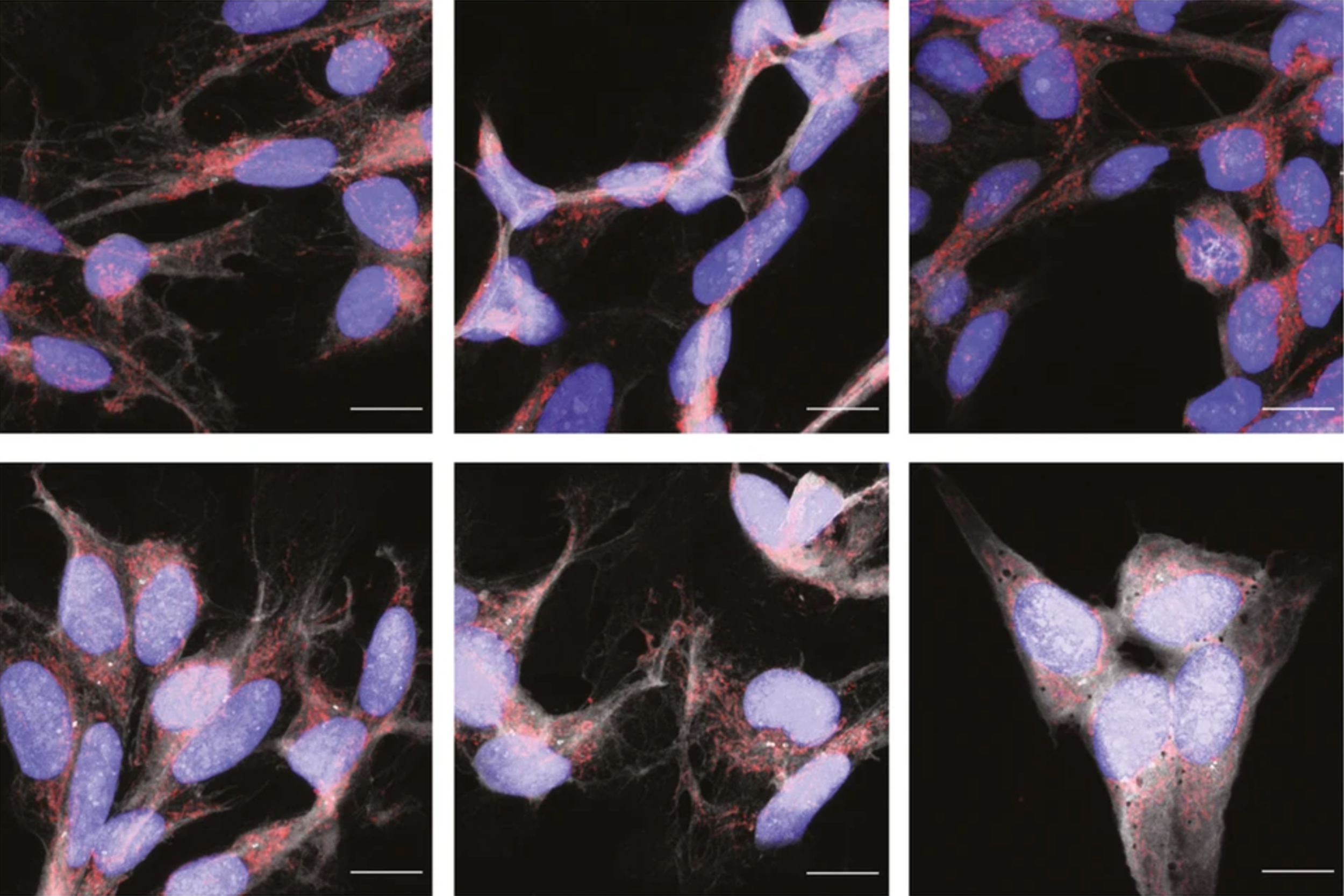 Tau-treated cells.