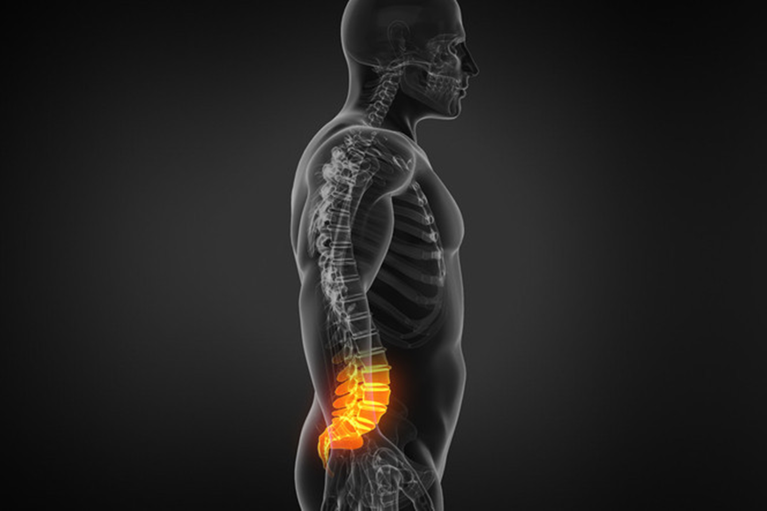 Illustration of lower back pain.