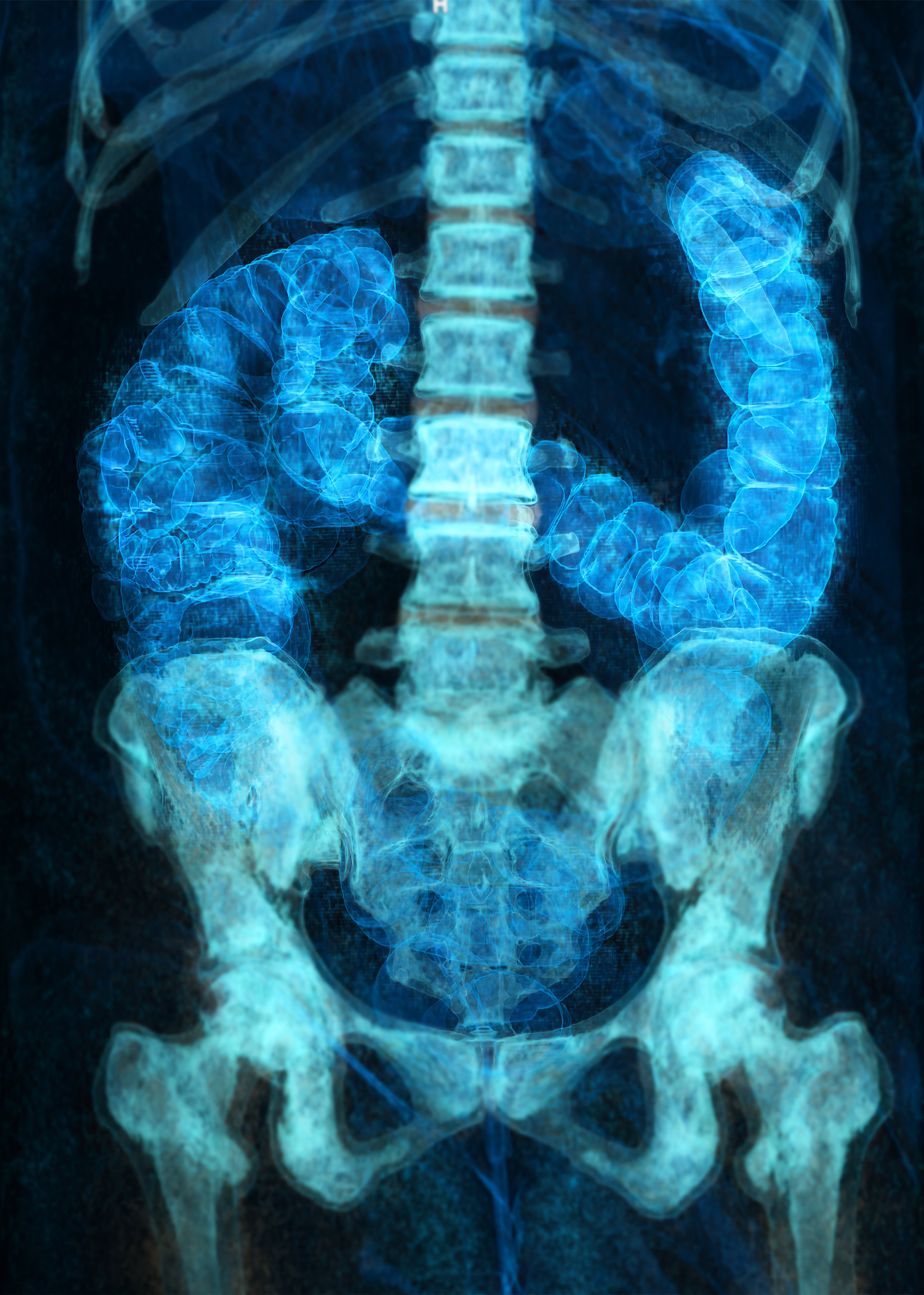 Rendering image for screening colorectal cancer.