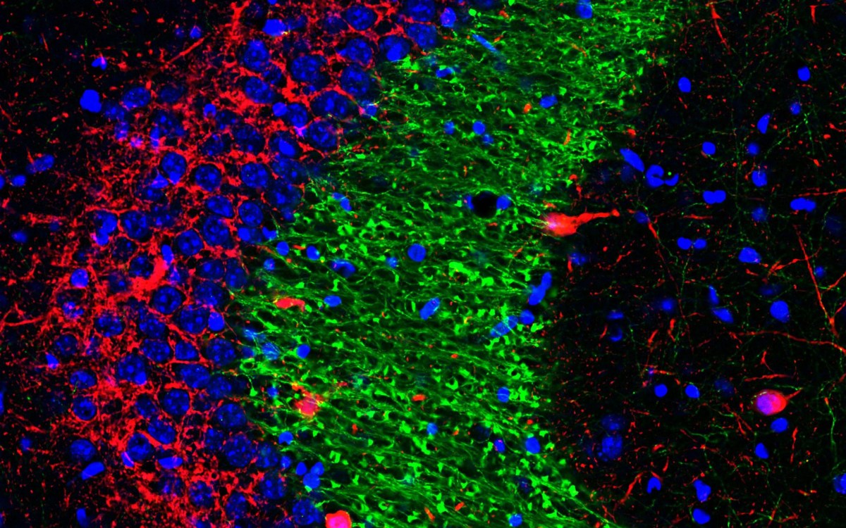 dentate gyrus cell