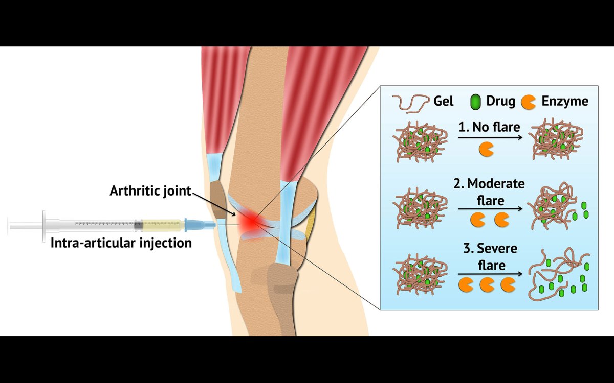 A delivery system using hydrogel