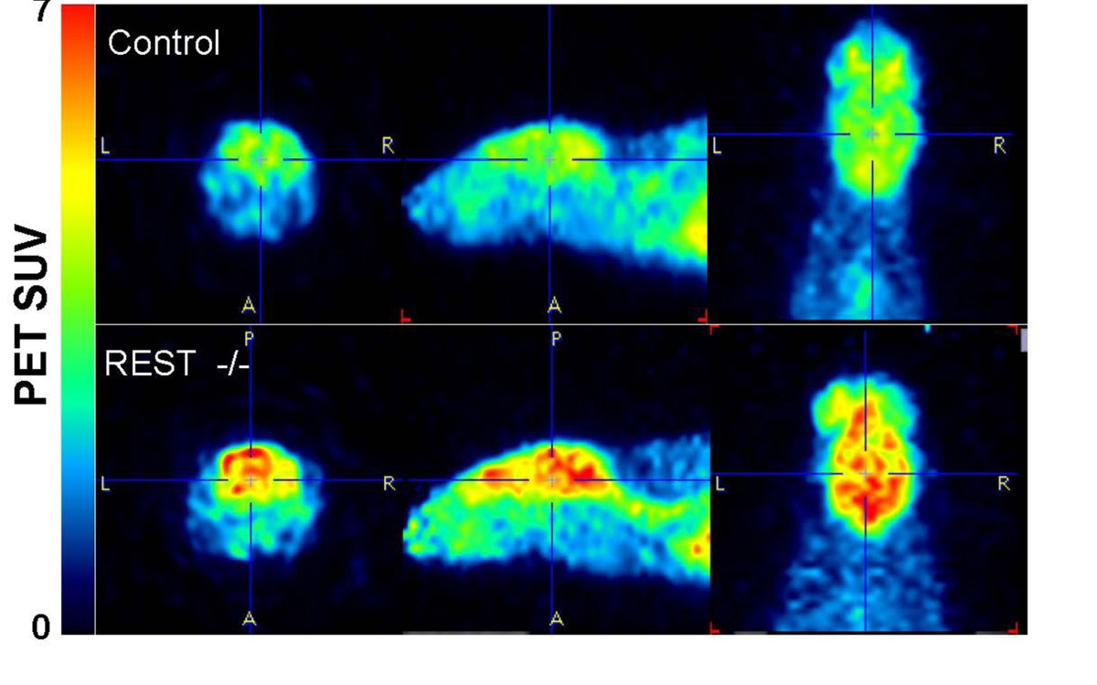 Mice lacking the protein REST (bottom) showed much higher neural activity in the brain than normal mice.