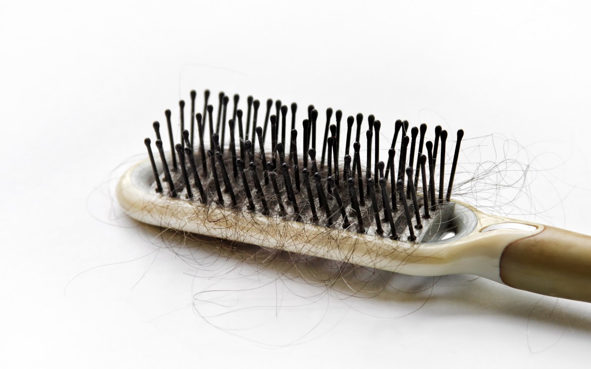 Hair loss concept of close up hairbrush and fallen hair.