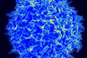 Healthy T cell.