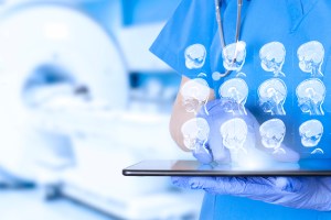 Radiologist looks at child's brain scans.