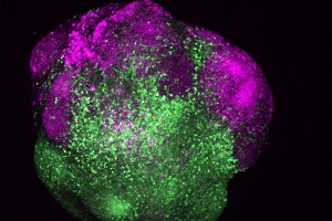 Human brain organoid